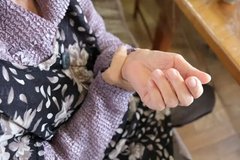 パーキンソン病の「寿命」と前向きに向き合うために