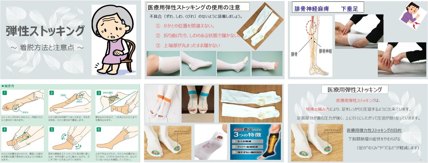 医療勉強会:医療用弾性ストッキング｜アクティブステージ岐阜