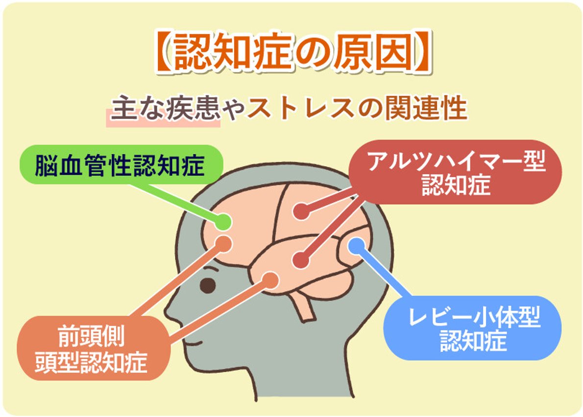 認知 症 遺伝 する か
