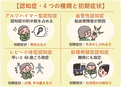 認知症には4つの種類がある それぞれの特徴 初期症状と相談先 Lifull介護 旧home S介護 認知症には4つの種類がある それぞれの特徴 初期症状と相談先 Lifull介護 旧home S介護