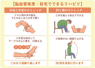 はじめての方へ 脳血管疾患のリハビリはこれ 意欲を引き出すポイント Lifull介護 旧home S介護